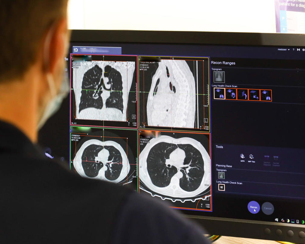  UK: NHS spends record £241m outsourcing scan analysis to private firms